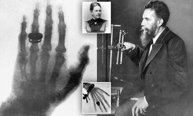 La primera radiografía de la historia